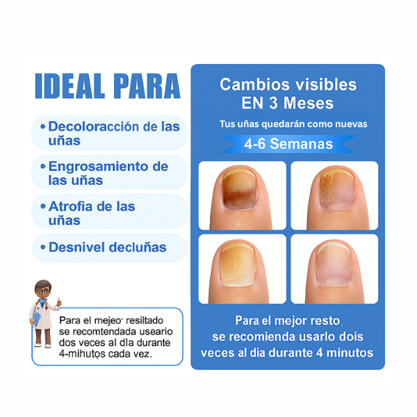 MycoLáser™ – Dispositivo Láser Antihongos para Uñas