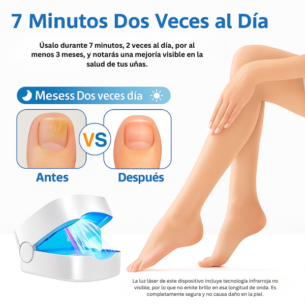 MycoLáser™ – Dispositivo Láser Antihongos para Uñas