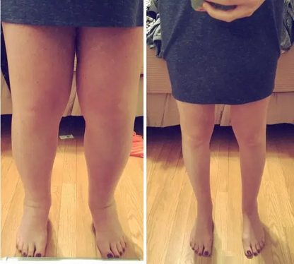 RelaxPie™ Masajeador de piernas 3-en-1