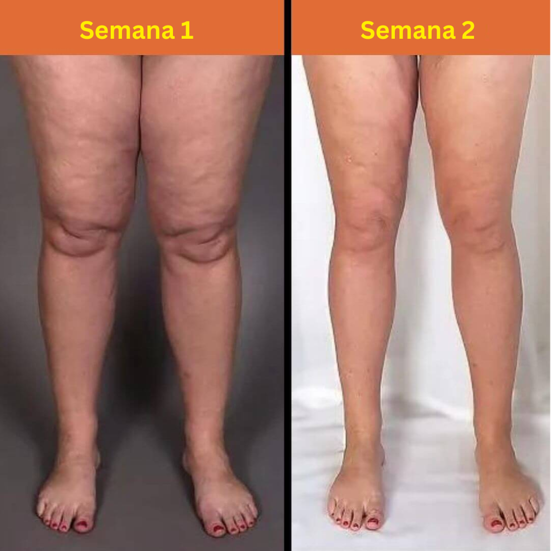 RelaxPie™ Masajeador de piernas 3-en-1