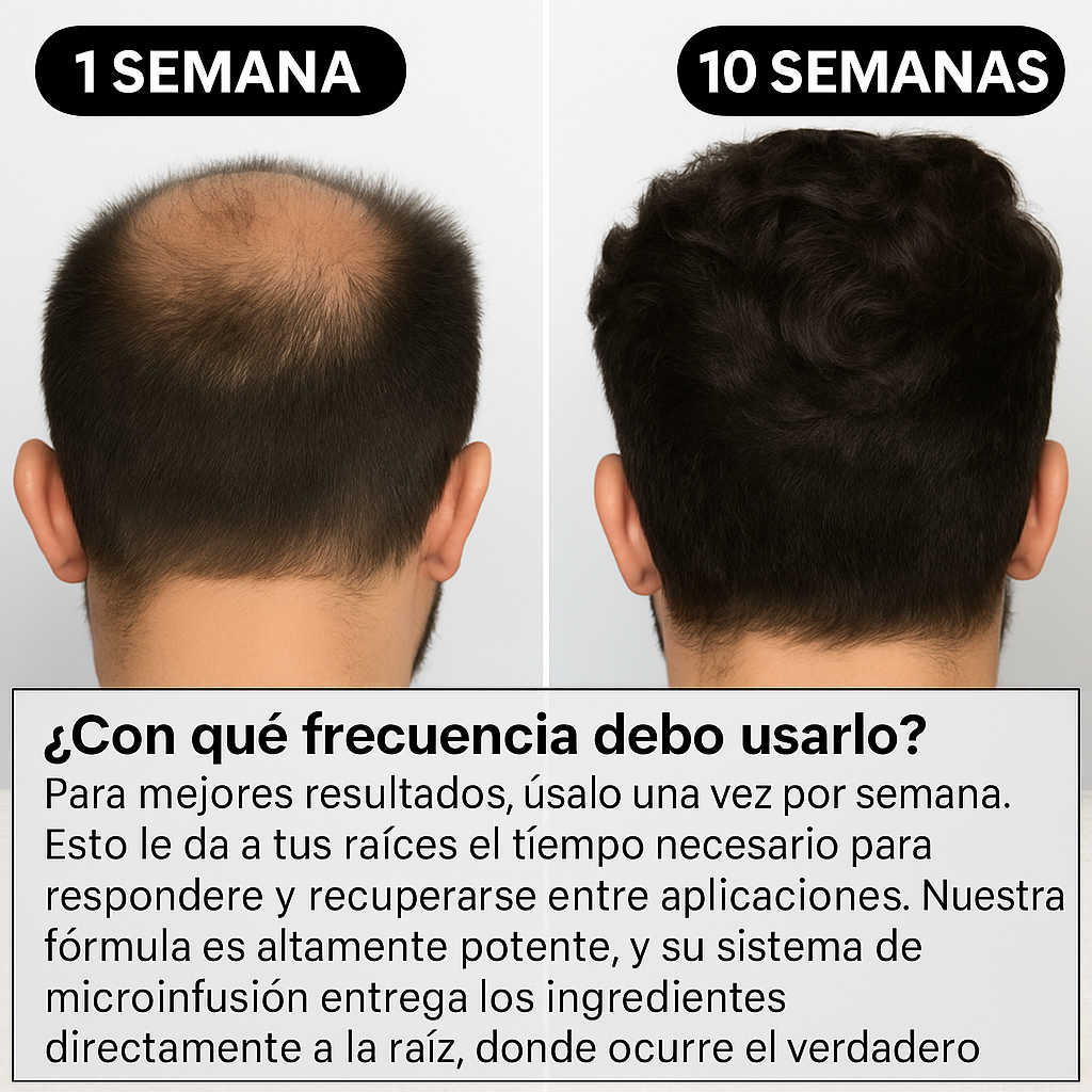 BioAQUA™ - Solución alopecia