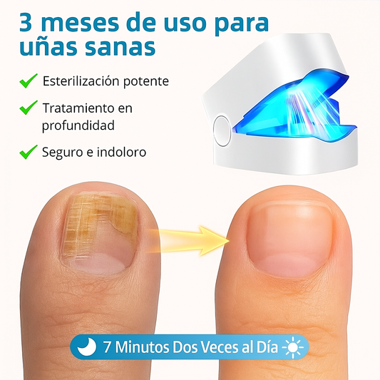 MycoLáser™ – Dispositivo Láser Antihongos para Uñas