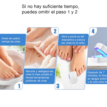 MycoLáser™ – Dispositivo Láser Antihongos para Uñas