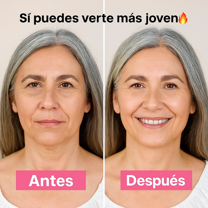 Dispositivo de Rejuvenecimiento Facial